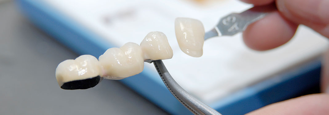 Ästhetische Zahnmedizin